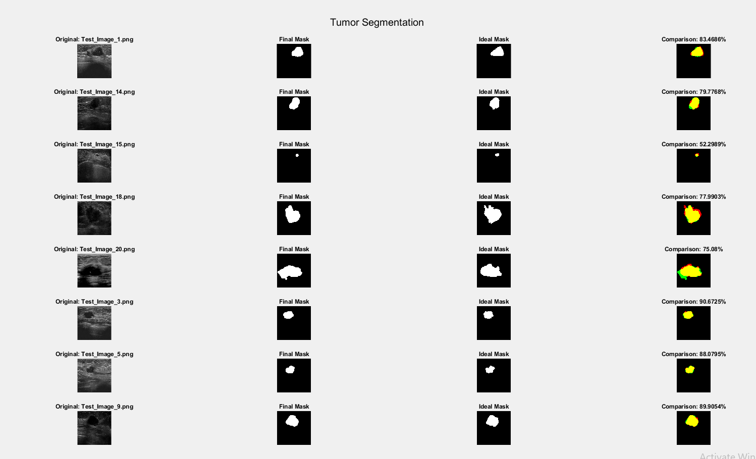 Tumor Segmentation